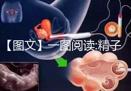 【圖文】一圖閱讀:精子和卵子結(jié)合有多難！