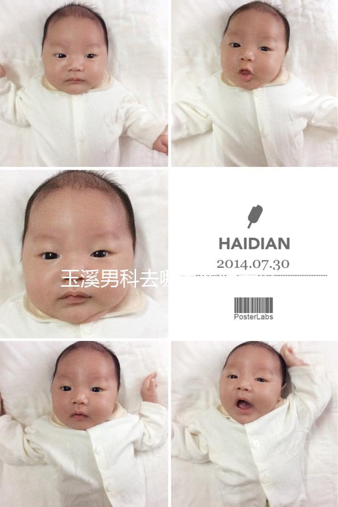 玉溪男科去哪家醫院看好，怎么選攻略，這個排行榜不要錯過