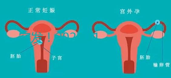 突發(fā)！2024.11.15，天津試管嬰兒納入醫(yī)保報銷（附14家醫(yī)保定點醫(yī)院）