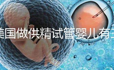 美國做供精試管嬰兒有三大條件，想知道需不需要結婚證戳