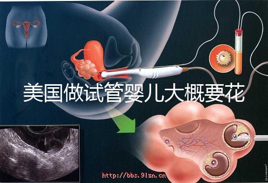 美國做試管嬰兒大概要花多少錢？具體支出25w！