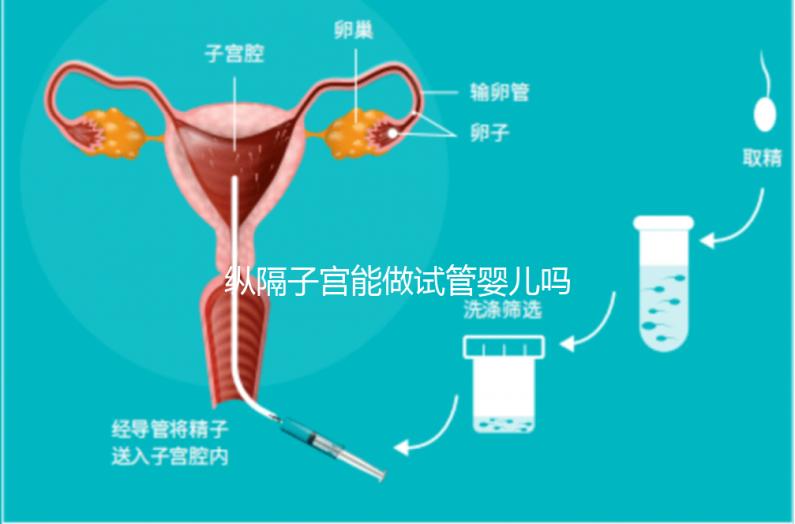 縱隔子宮能做試管嬰兒?jiǎn)?醫(yī)生:可以做,但要手術(shù)治療再進(jìn)周