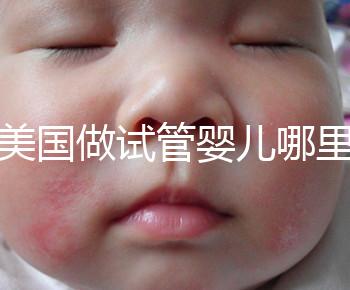 去美國做試管嬰兒哪里最好，4家好評輔助生殖機構推薦