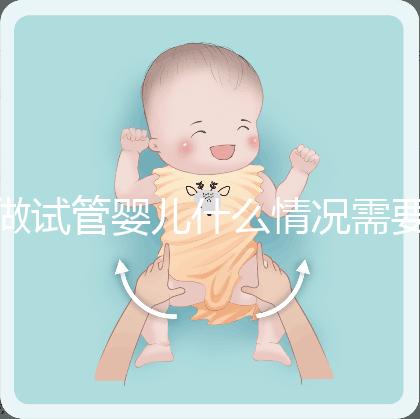 做試管嬰兒什么情況需要做染色體檢查？