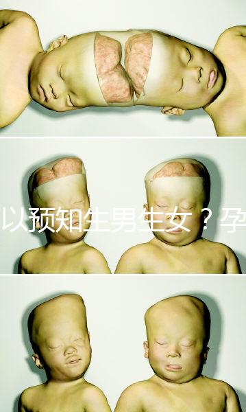 可以預(yù)知生男生女？孕婦夢(mèng)見馬的胎夢(mèng)解讀