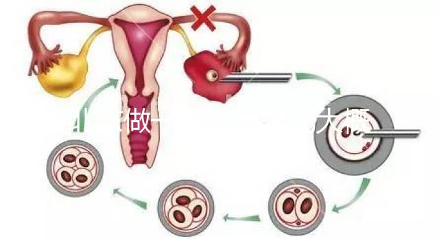 北京做一次試管嬰兒大概花多少錢？2025年價(jià)格及明細(xì)清單一覽！