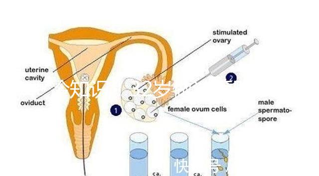 冷知識！32歲做試管嬰兒提升成功率的方法請收藏