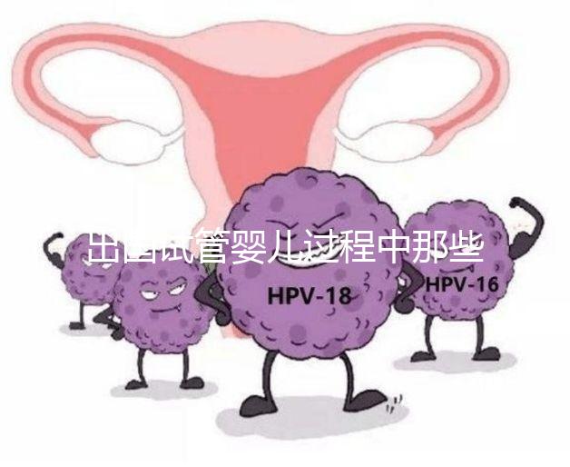 出國試管嬰兒過程中那些困惑，12個(gè)常見問題釋疑