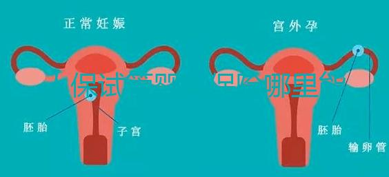 人保試管嬰兒保險哪里能買、怎么買速覽，一篇看懂不踩坑