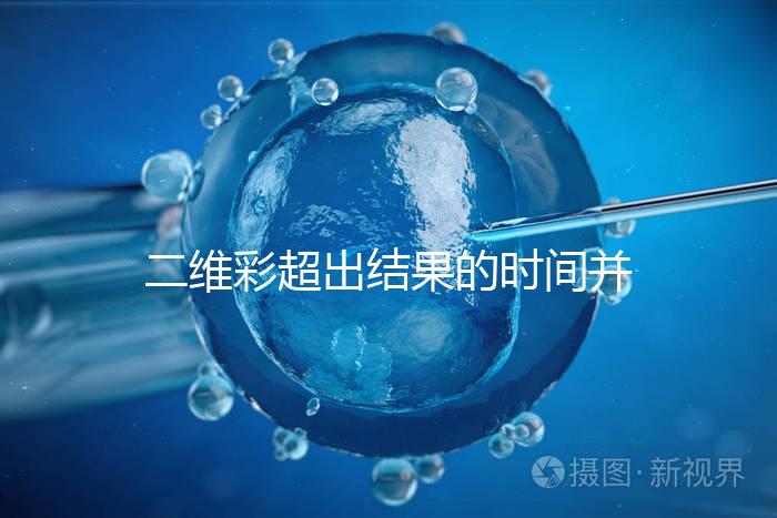 二維彩超出結果的時間并不長,從檢查流程便可看出