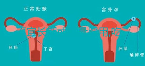 不宜長期或過量服用,吃DHEA要注意這3點(diǎn)