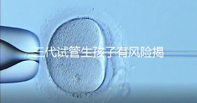 三代試管生孩子有風險揭秘嗎？嬰兒會有問題嗎？