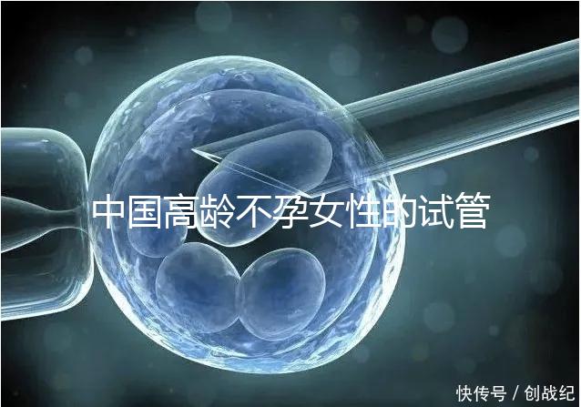 中國(guó)高齡不孕女性的試管嬰兒指南,8個(gè)方面5條推薦意見