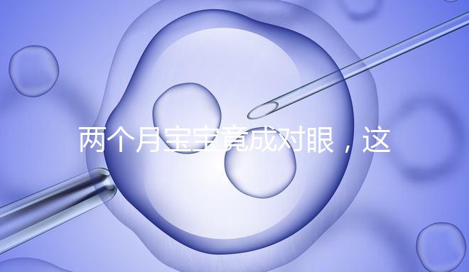 兩個(gè)月寶寶竟成對(duì)眼,這5大形成原因家長(zhǎng)必知