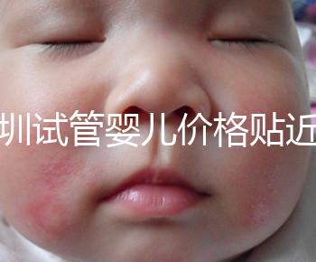 深圳試管嬰兒價格貼近百姓!三代試管只需8