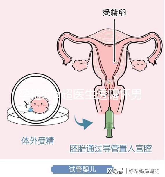 孕檢時b超醫生透露懷男寶女寶暗語寶典，一語戳中有心人！