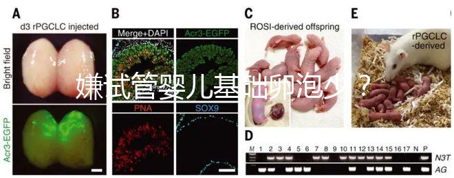 嫌試管嬰兒基礎卵泡少？并非只能食療，這份增多錦囊請收下