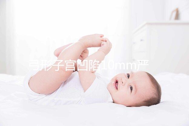 弓形子宮凹陷10mm嚴(yán)重嗎？判斷輕重的最佳方法送給你