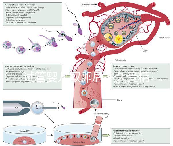 試管嬰兒取卵后多久受精(取卵第二天被告知精卵不結合)