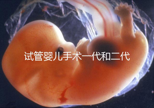 試管嬰兒手術一代和二代有哪些區(qū)別?