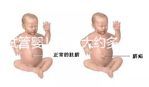 試管嬰兒費(fèi)用大約多少2021(試管嬰兒費(fèi)用大約多少2021年鄭州)