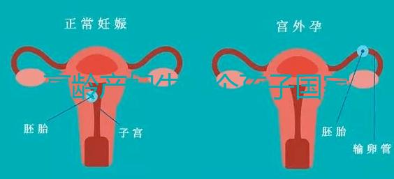 高齡產(chǎn)婦生八個(gè)孩子國家有補(bǔ)助?有沒有違法才是關(guān)鍵