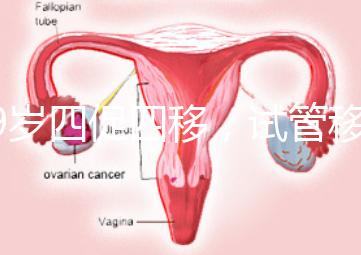 39歲四促四移，試管移植失敗5次后應(yīng)該怎么辦？