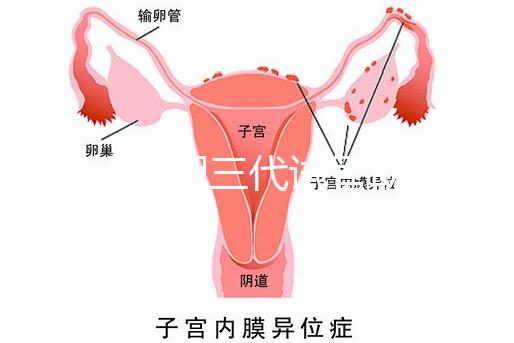 2025昆明三代試管助孕費用一覽，8-15萬元，價格透明公開自主選擇