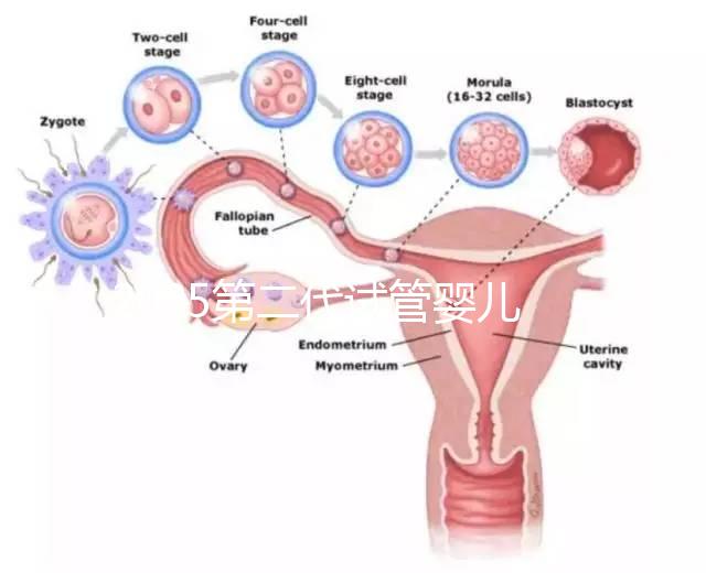 2025第二代試管嬰兒全流程解析:從檢查到移植各階段費(fèi)用數(shù)據(jù)揭秘